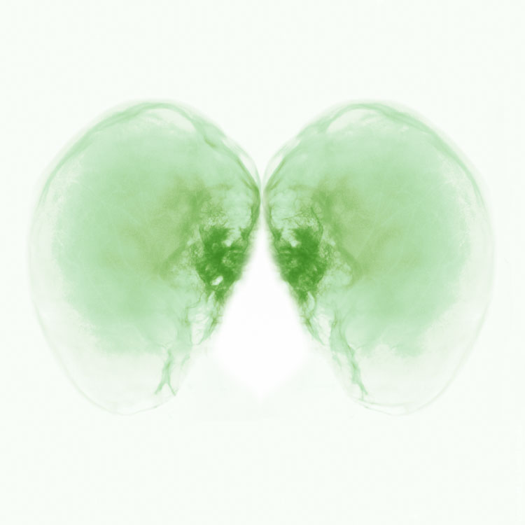 Digitalis – Fotografie und Anatomie in der Digitalen Evolution – gesunde Lunge (weil grün)